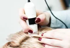 A fejbőr leggyakoribb betegségei. Okok és típusok